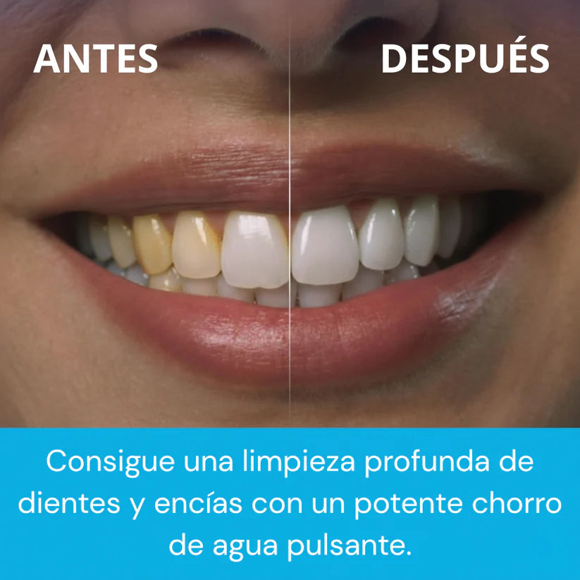 HydroSmile Pro™- ¡Dile adiós al sarro, al mal aliento y a las caries en solo semanas!