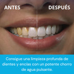 HydroSmile Pro™- ¡Dile adiós al sarro, al mal aliento y a las caries en solo semanas!